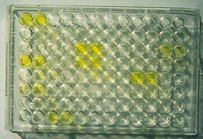 Nachweisbarkeit von Rebvirosen mittels ELISA in Abhängigkeit vom Reborgan